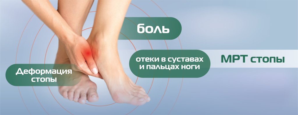 МРТ_нижние конечности, стопа(БЕЗ ЦЕНЫ) (2).png